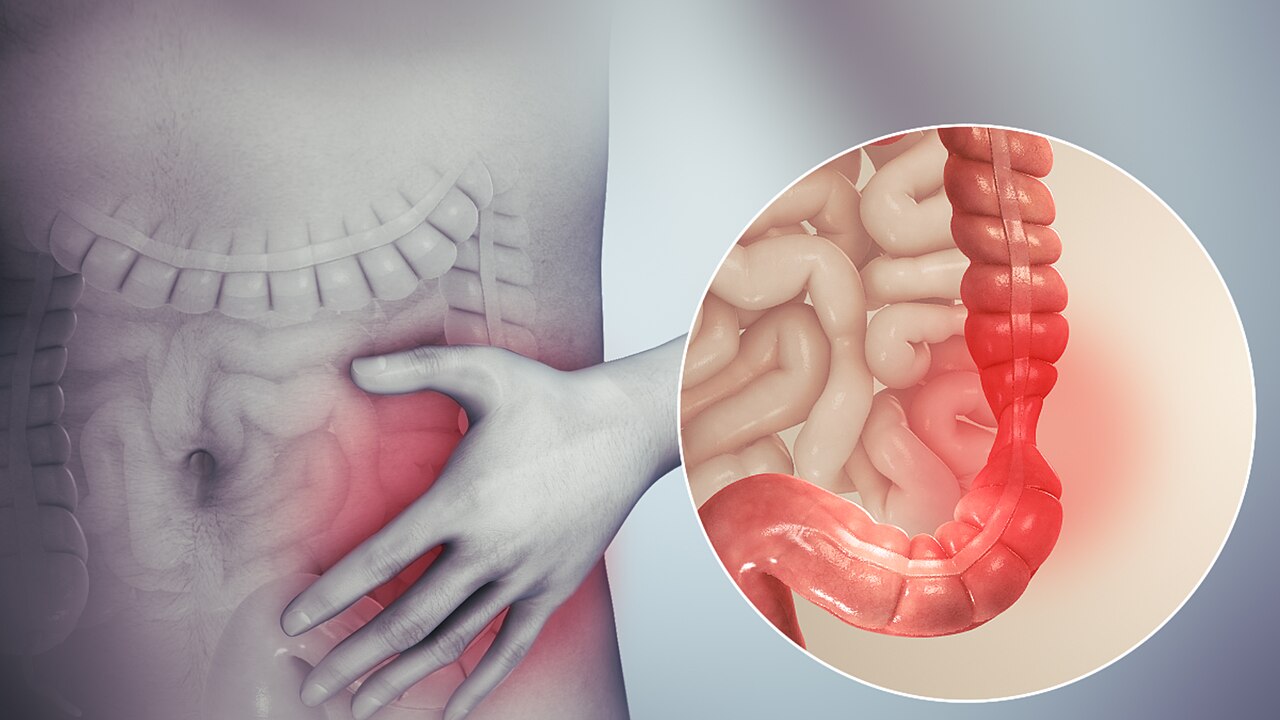 Digestive /IBS issues